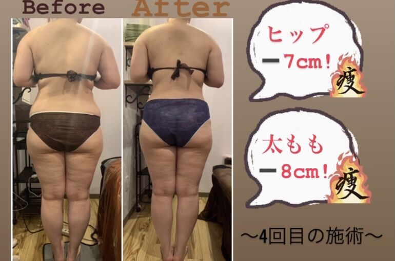 15BCA1C1-C5CF-4C2B-958D-8DDDC3897366