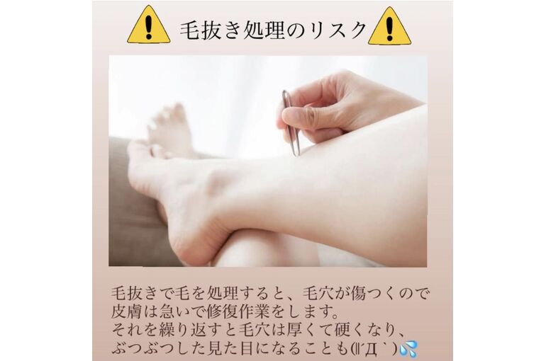 A56FB8E3-5229-4950-AFE2-A1F452D2BC97