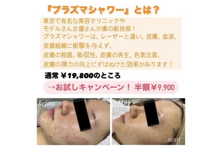 3F493A0D-4E58-47B9-A58A-B693002EA54A